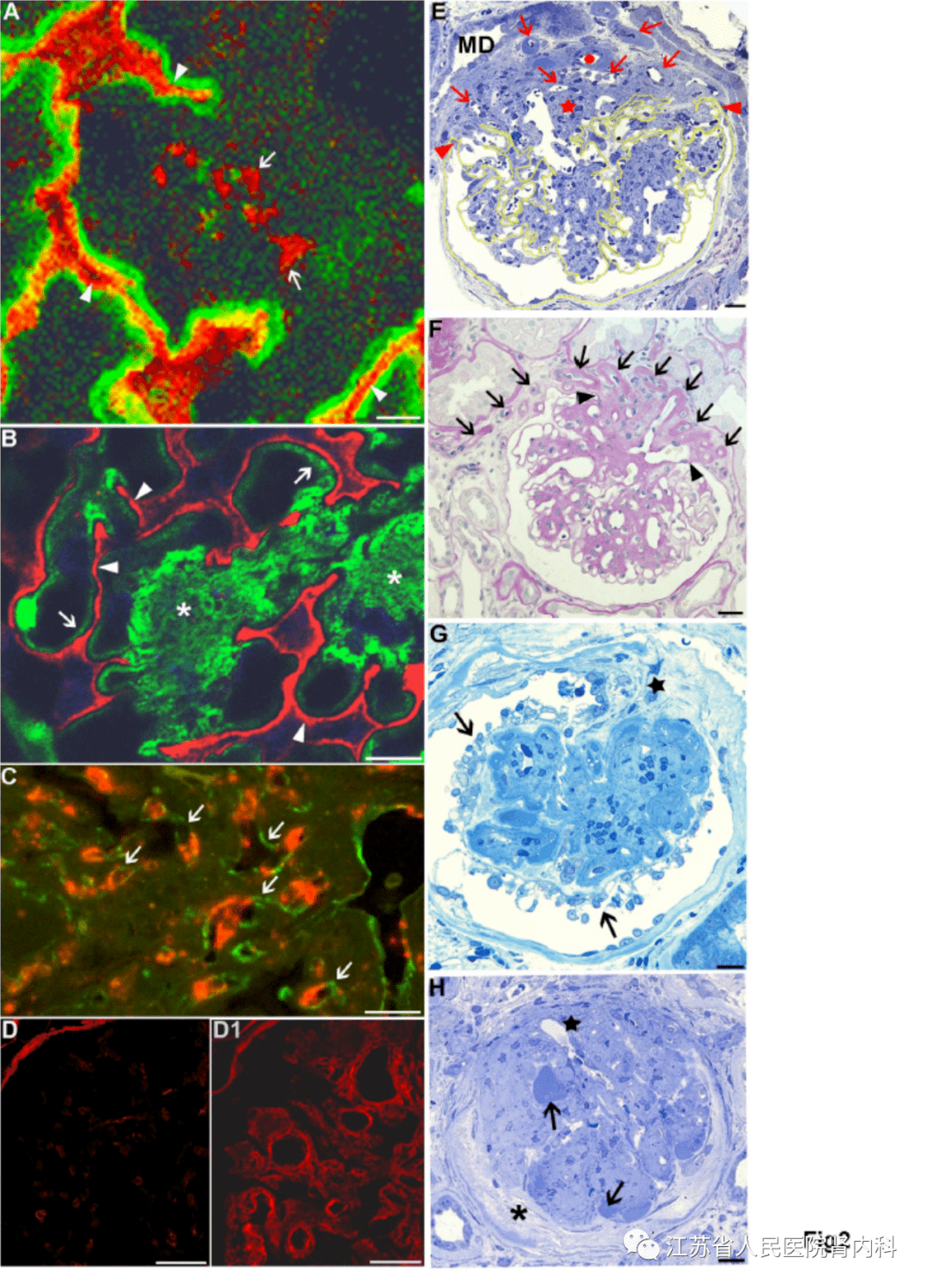 【文献速递】人类糖尿病肾病复杂病理过程的观念更新