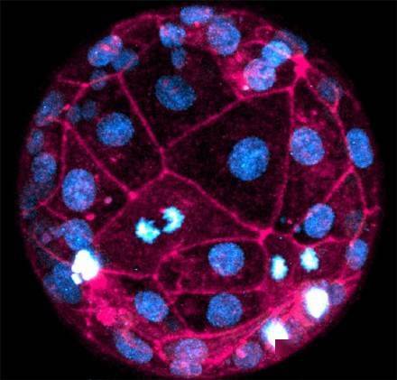 迄今最高分辨率人类胚胎发育图面世 