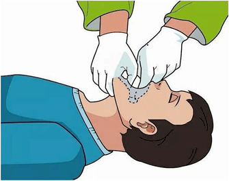 塞压舌板或勺子等保护舌头:大部分患者抽搐时发生舌咬伤的概率并不大