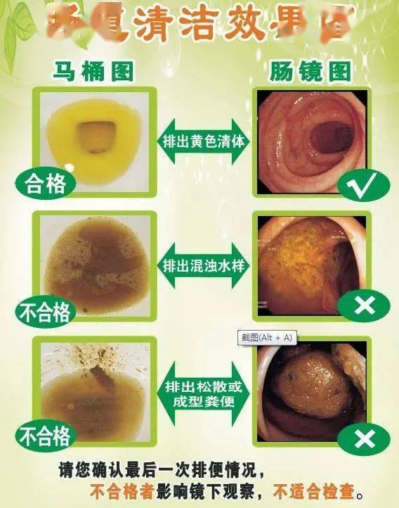 做肠镜大便清水样图片图片