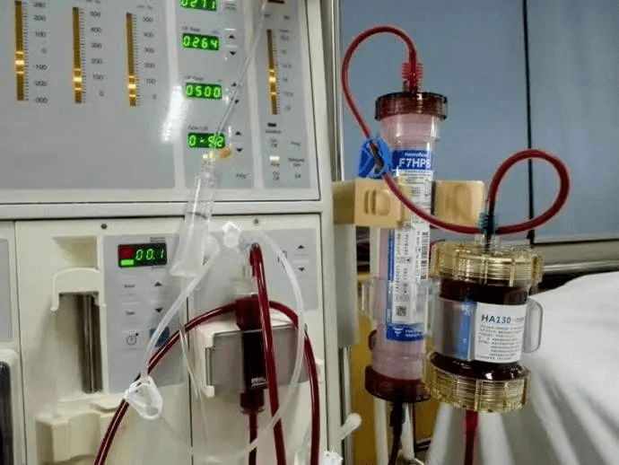 蛋白结合类毒素及多种炎症介质的不足,但是由于组合型人工肾体外循环