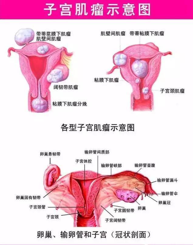 妇科图片卵巢在哪里图片