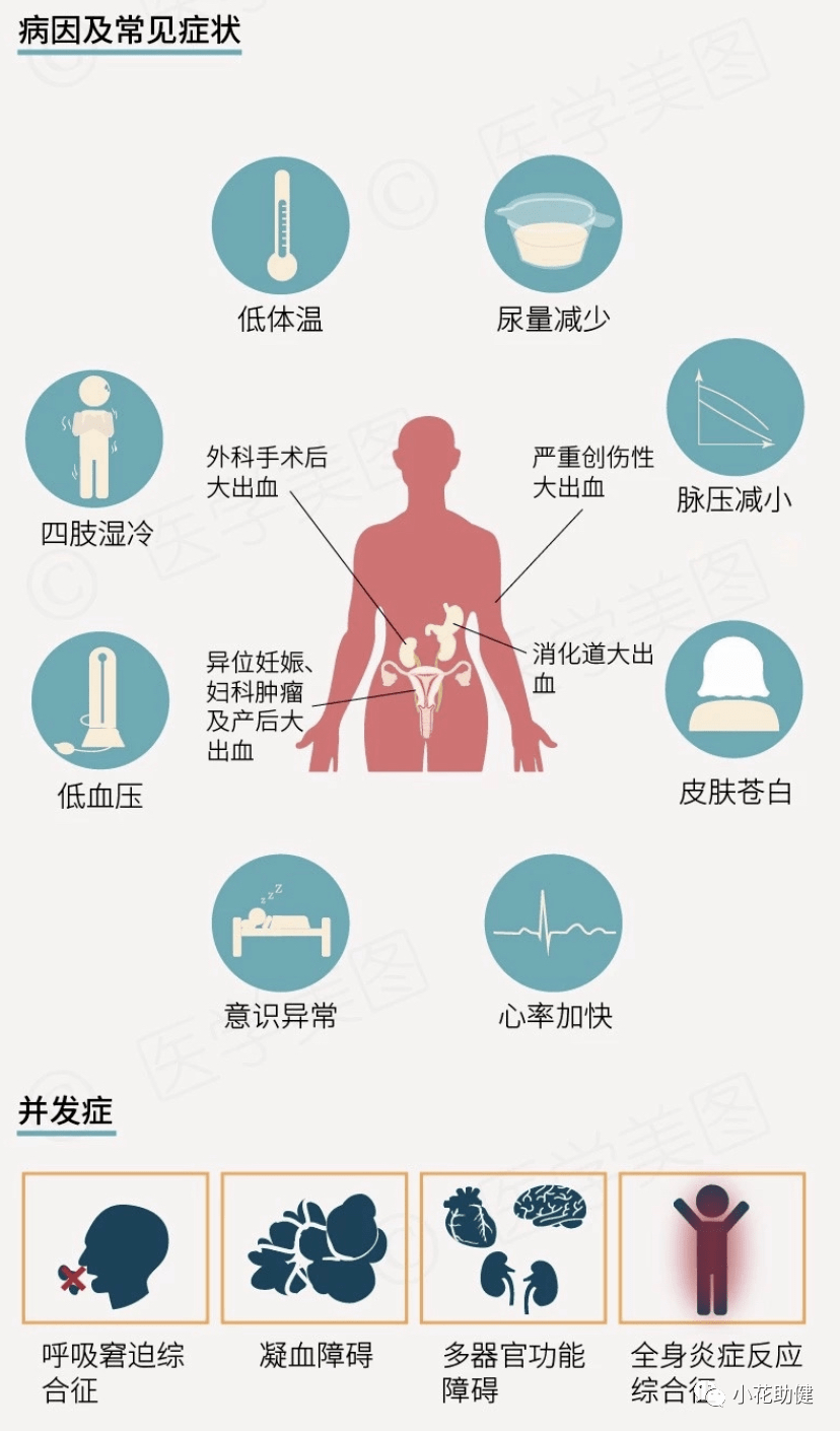 创伤失血性休克的应对及护理措施_搜狐网