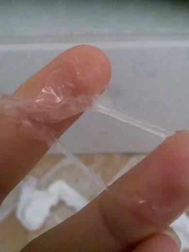 别拒绝,女人都应该看看!_女性_雌激素_粘液