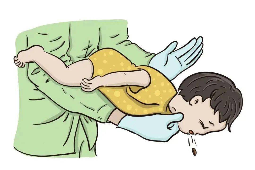 这些急救方法关键时候能救命……扶我起来,我还能学!_患者_异物_腹部