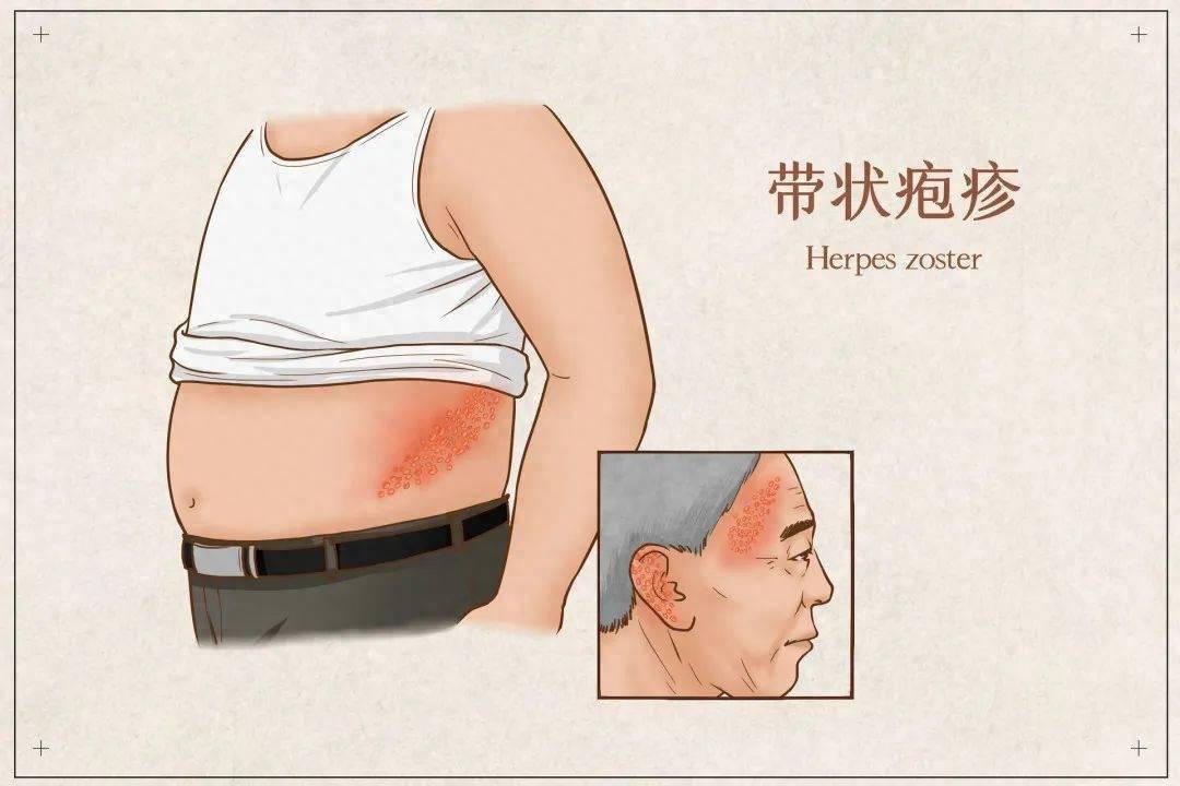 这些预防妙招快收好_治疗_陈威_阿姨