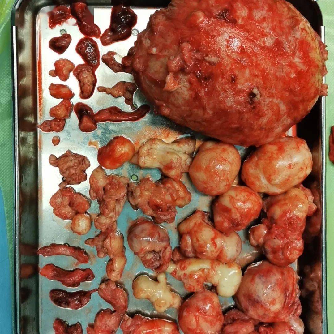 这到底是怎么了?_郑州_王娜_治疗