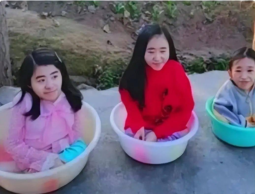 女子连生三个骨折症的“瓷娃娃,丈夫摔成脑震荡后,还拼命生第四胎