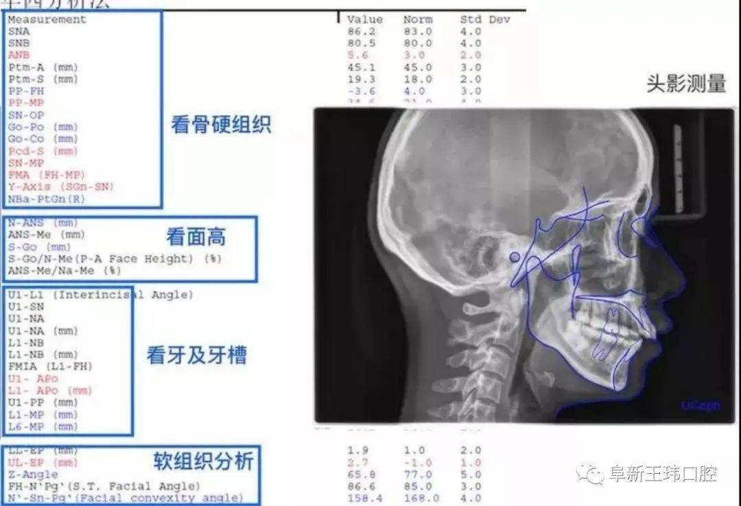 头颅骨内长满牙齿图片