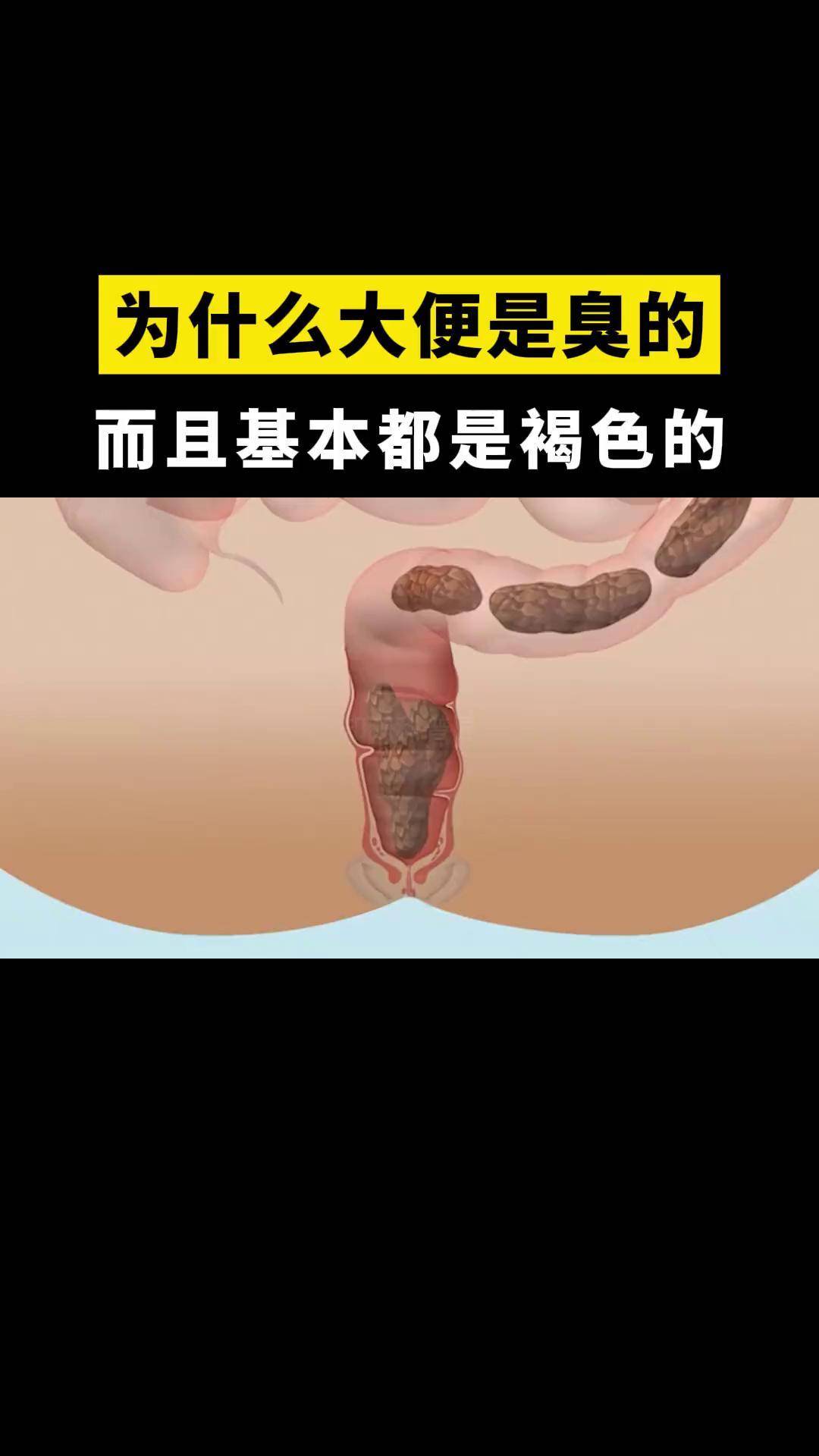 黄褐色屎图片