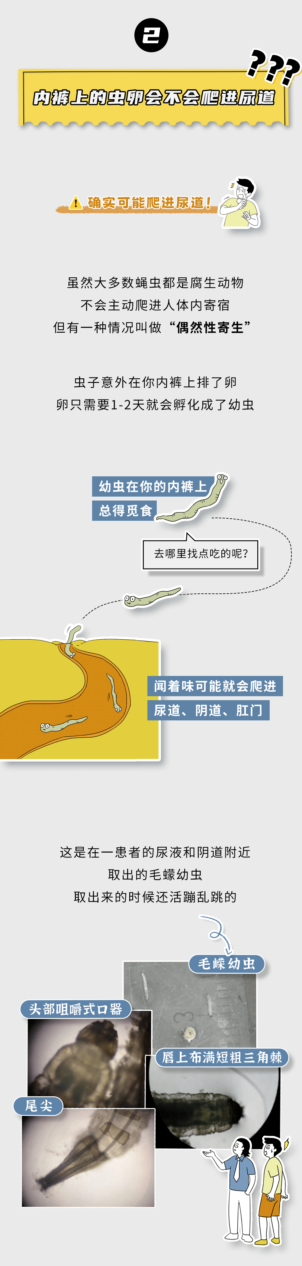 小孩尿道口有白色线虫图片