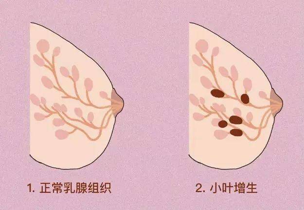 女性乳房图片节假图片