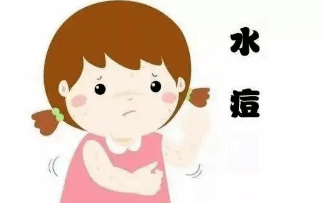 幼儿园预防水痘ppt图片图片