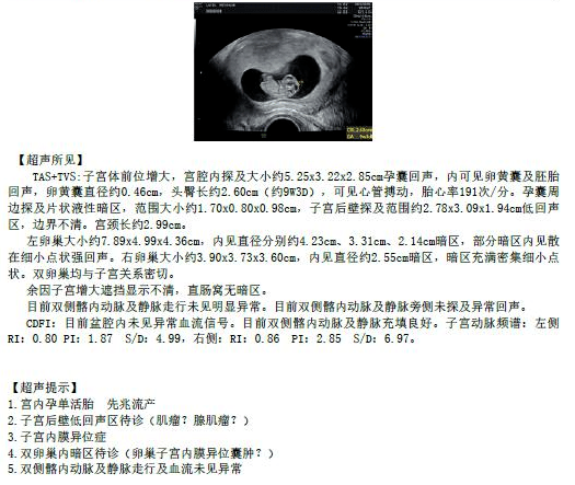 怀孕报告单图片清晰图片