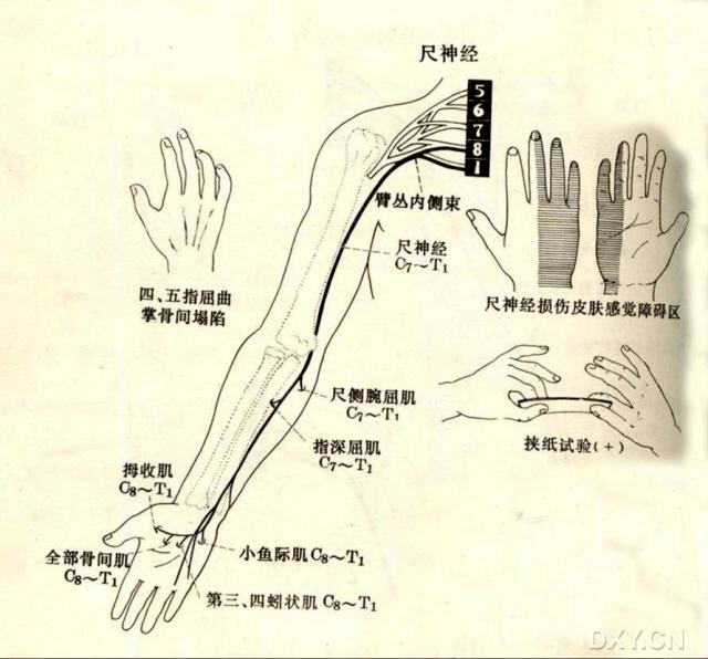 尺神经位置图图片