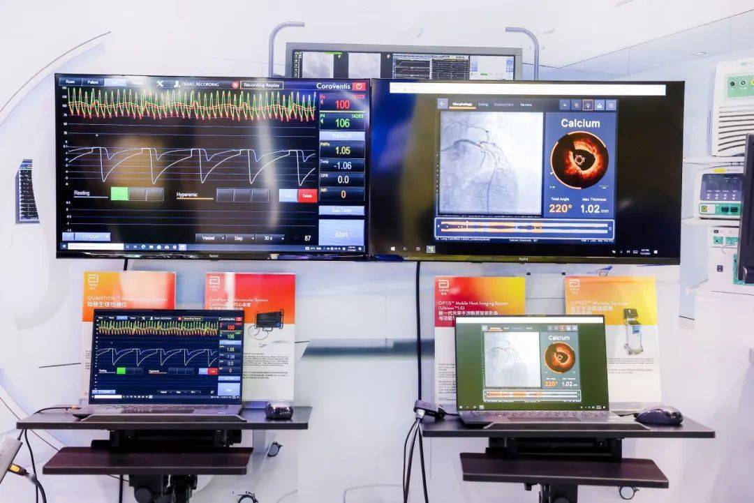 此届进博会上,雅培还展示了其在血管领域丰富的产品线和前沿解决方案