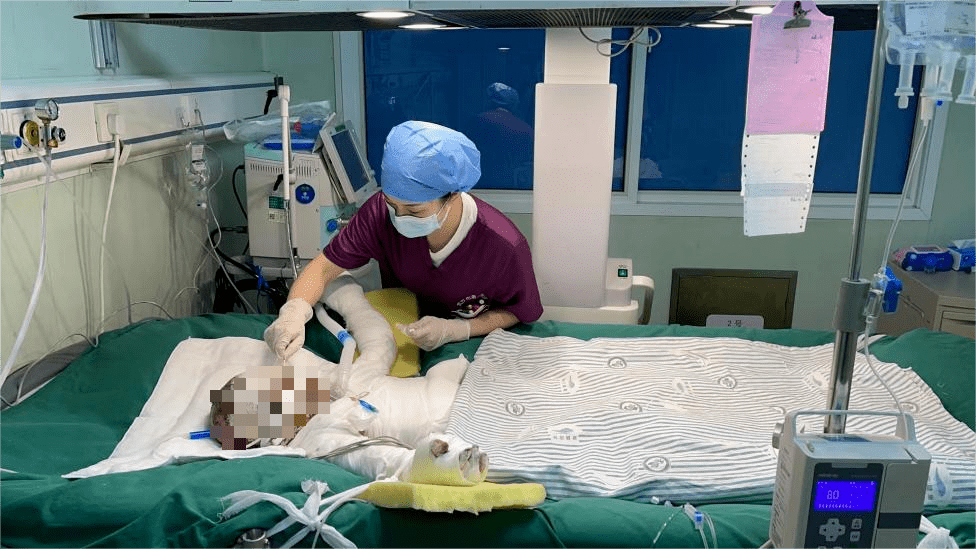 目前病情仍十分危重,计划于明日行植皮手术,接下来还有多次清创换药