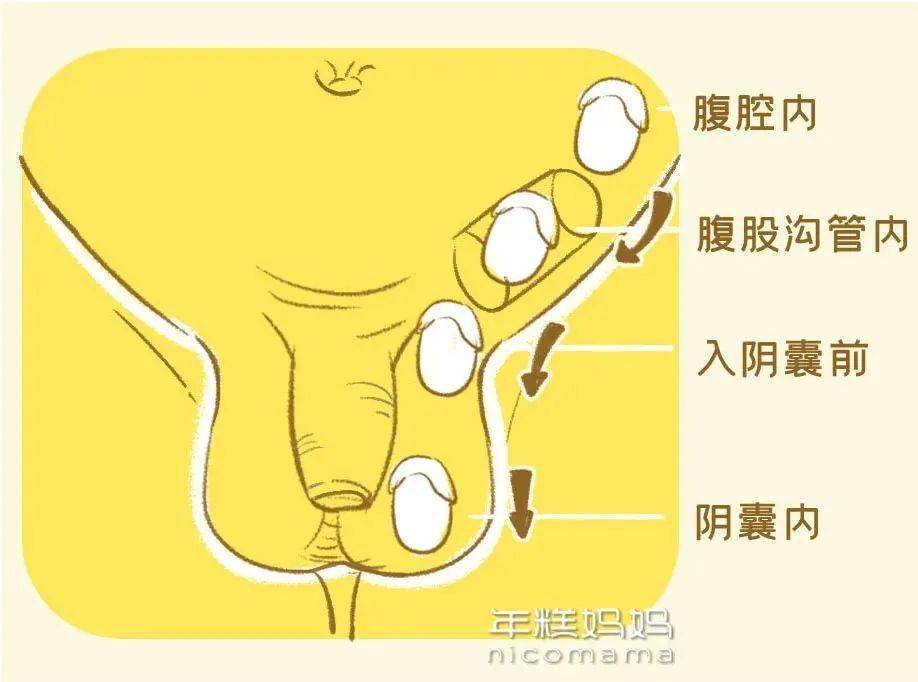男婴的睾丸正常的图片图片