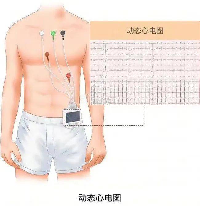 儿童心悸_检查_医生_患儿