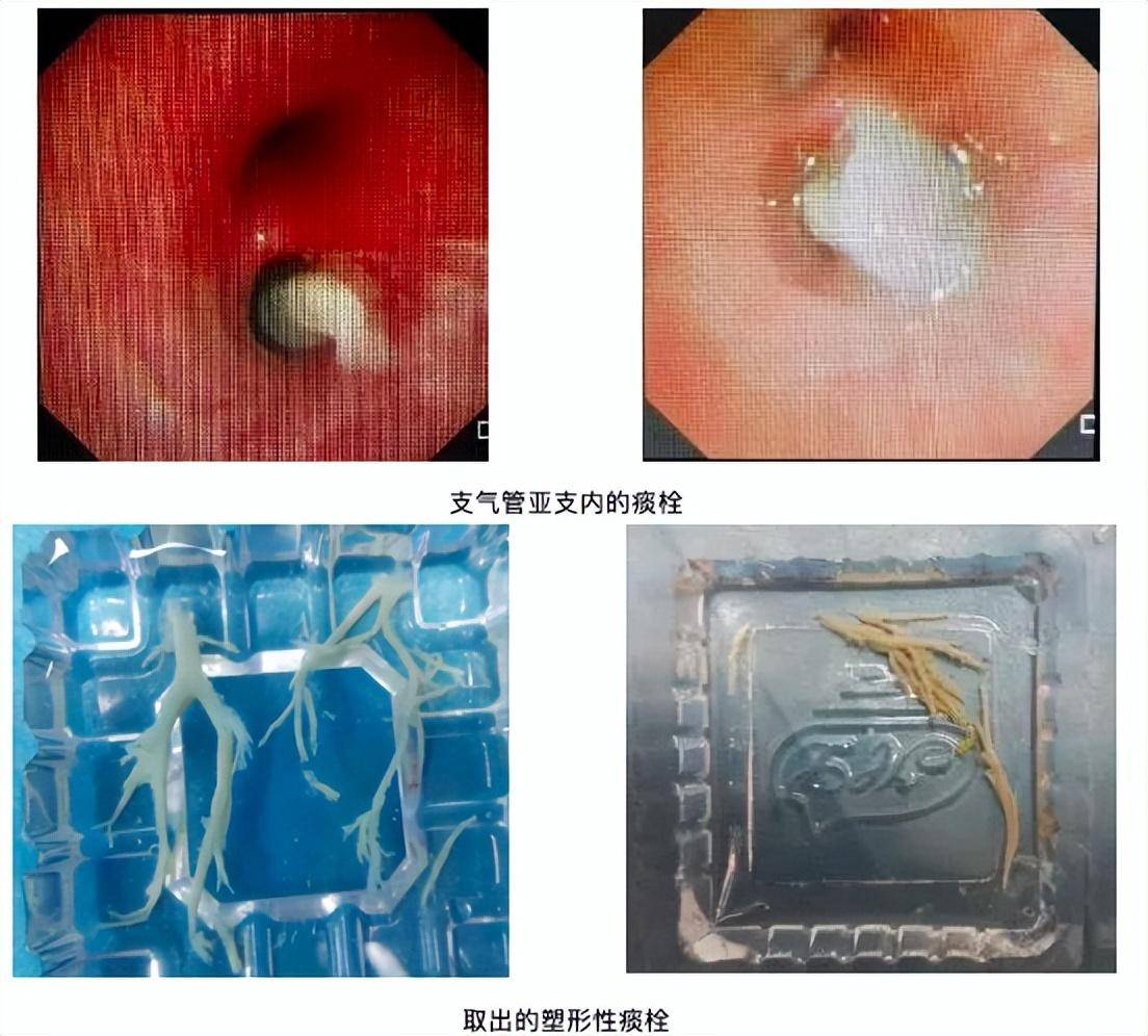 北戴河洗肺医院图片