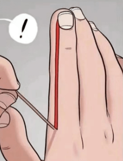 指甲周围总长倒刺,是缺维生素吗?_摩擦_伤害_手部