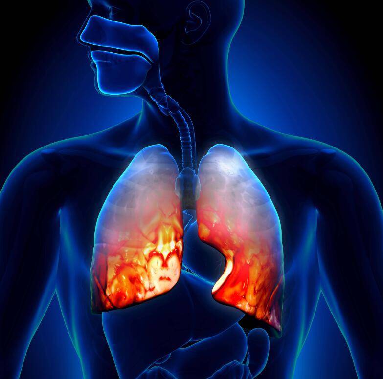 早期肺癌ct图报告单图片