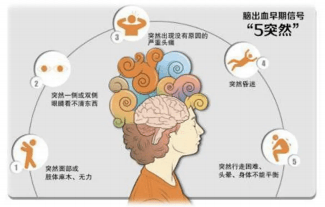 的基本病因●長期高血壓可使腦細小動脈發生玻璃樣變及纖維素性壞死