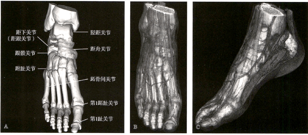 足踝關節解剖丨骨骼,關節,軟組織_韌帶_白箭_顯示