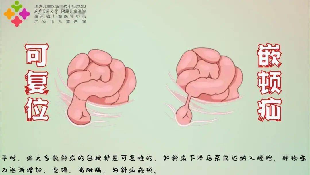 史莱姆膨腹动画图片