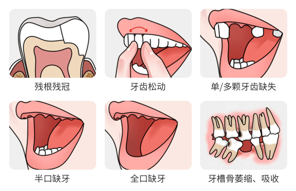 新一批消费券来了!(福州有18家可用)