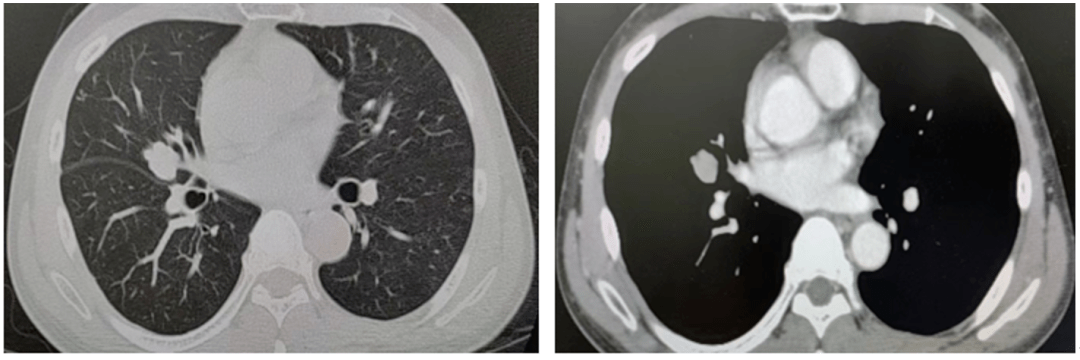 艾联合,新标"肝"丨综合疗法领跑诊治前沿,靶免介入联合治疗晚期肝癌