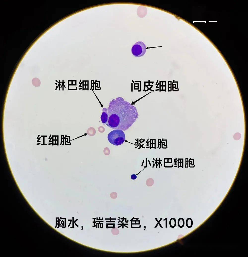 段师形态教学系列(第71期)_细胞_尿液_检验