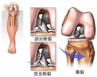 一個動作,每天10分鐘,正確保護你的膝關節_膝蓋_圖片_來源