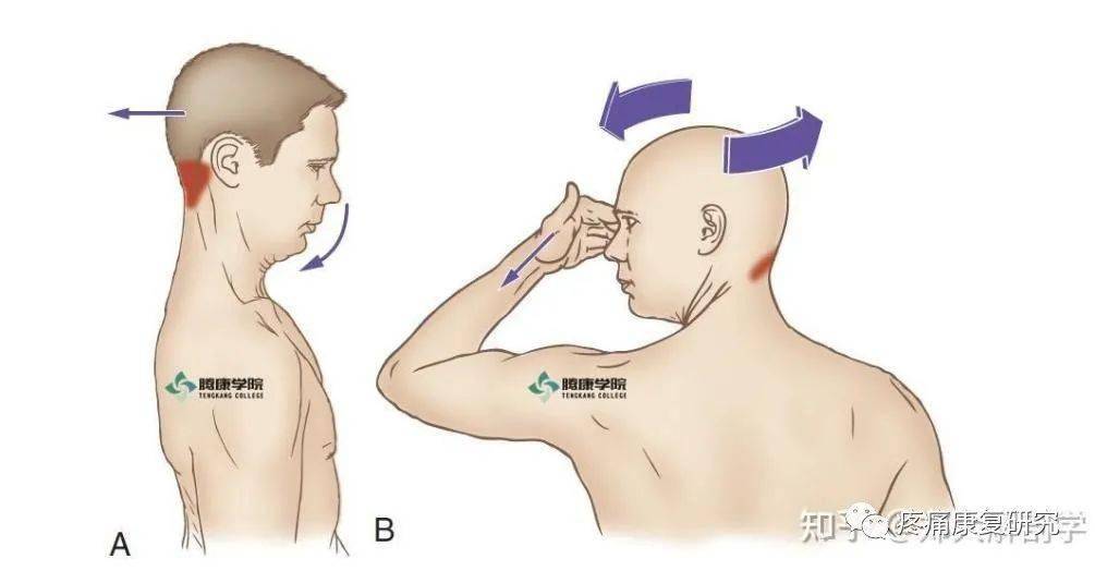 枕下肌群的解剖,功能及损伤原因和临床应用_肌肉_关节_头部