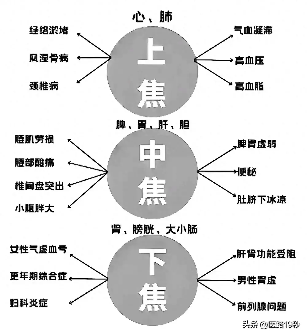 日常疾病的病灶都在哪里?上中下三焦