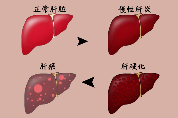 肝臟_症狀_研究