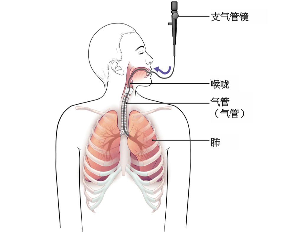 一探究