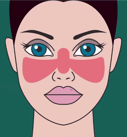 红斑狼疮尤其偏爱这样的女性,身体出现几种异常要小心!