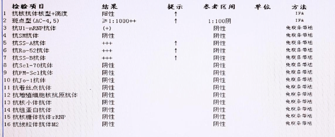 自身免疫抗體檢查:生化檢查:生化全套常規檢查:白蛋白33.