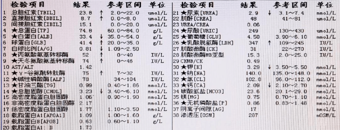 l ,天冬氨酸氨基轉移酶 74iu/ l ,γ﹣谷氨酰轉肽酶 75iu/ l ,總