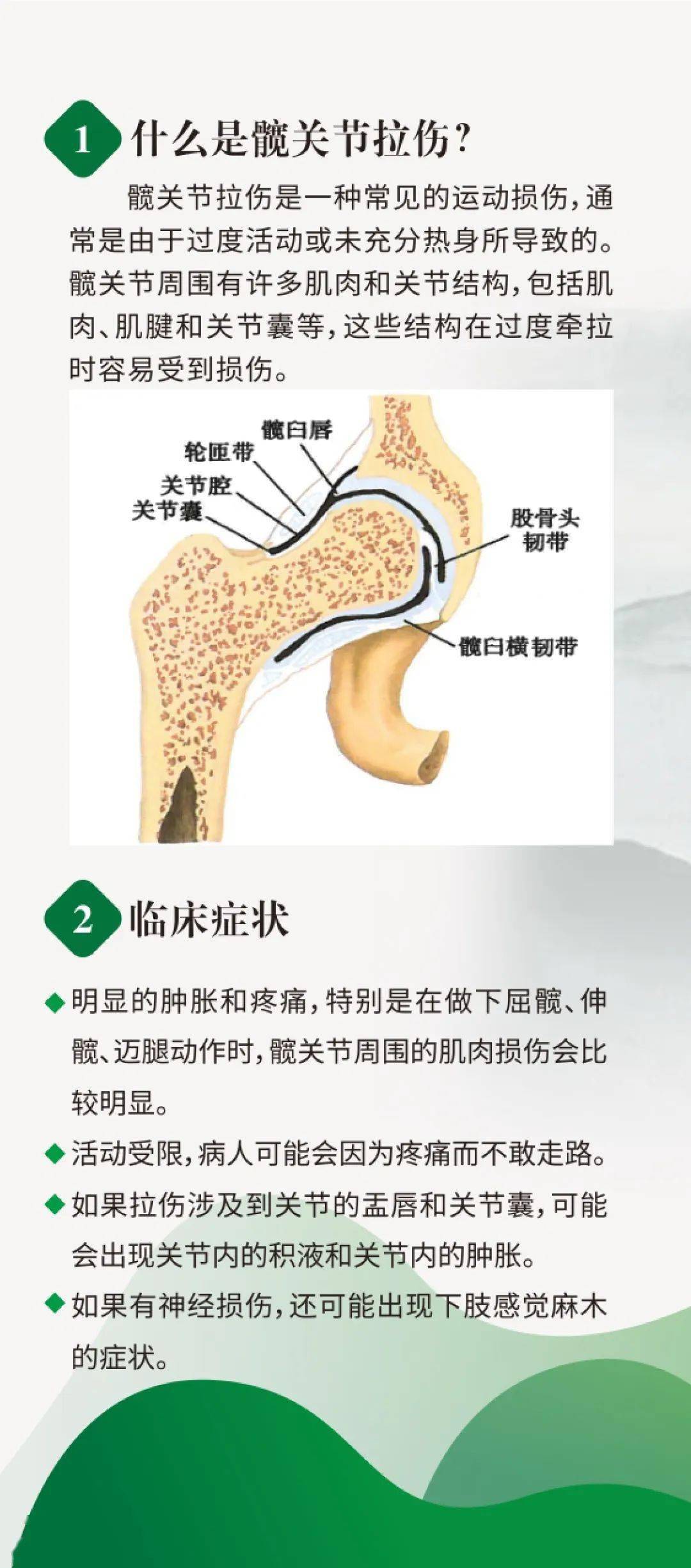 髋关节拉伤处理髋关节是股骨与髋骨的连接