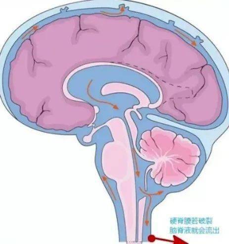 撞到頭部,當時檢查沒有嚴重的顱內損傷;劉先生自己也沒有明顯不適症狀