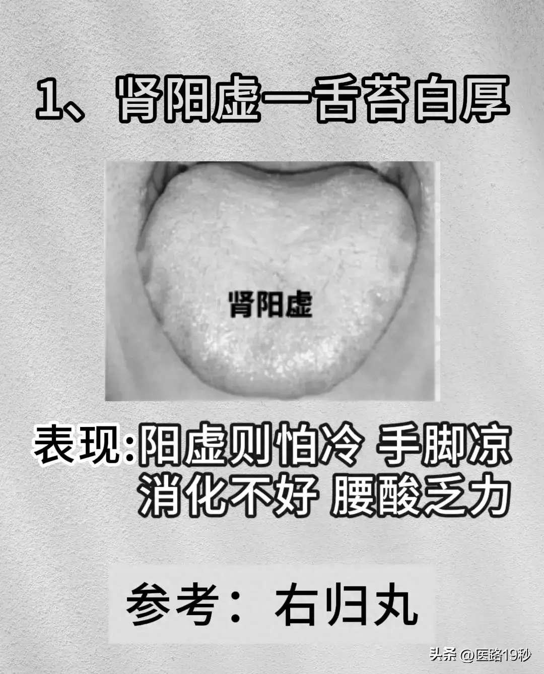 中医：从舌头看健康，舌象分析，常见的6种舌苔问题！和调理建议 - 知乎