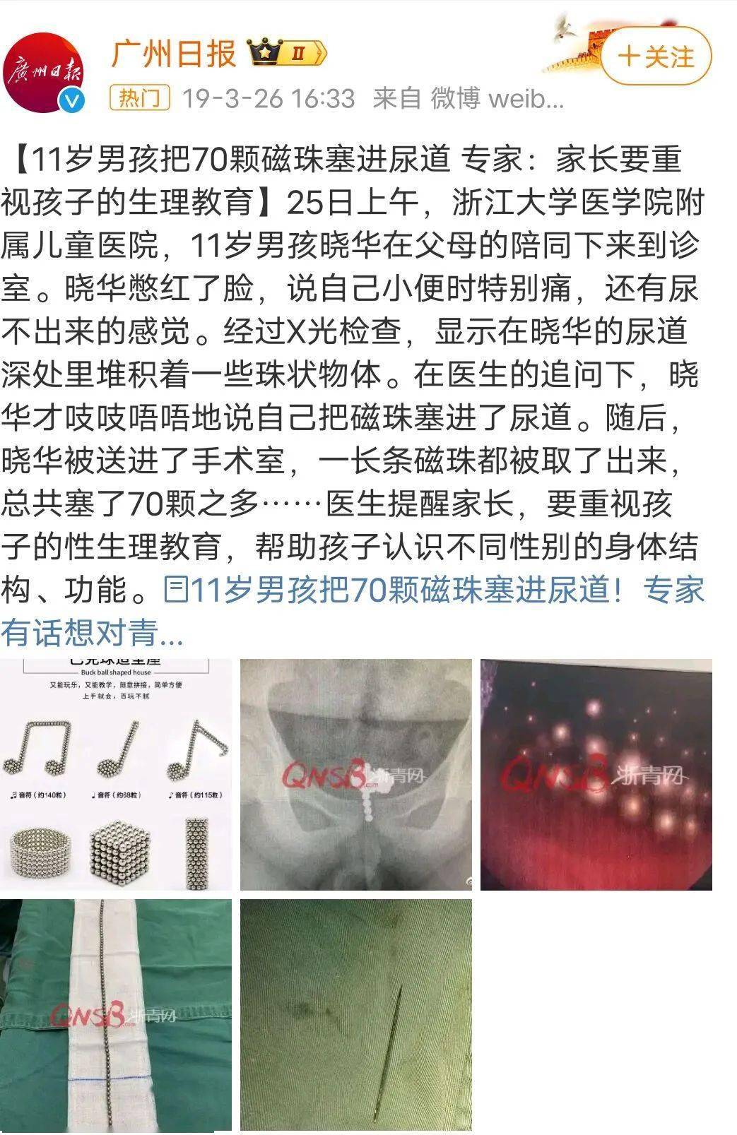 8岁儿童睾丸13×8 小孩图片