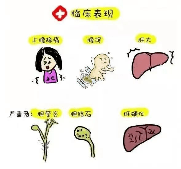 感染這種蟲子可能致癌!_膽管_淡水_膽汁