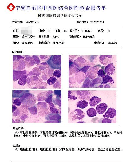 【知識集錦】胸腔積液嗜酸性粒細胞增多的原因及漿膜腔細胞形態檢驗的